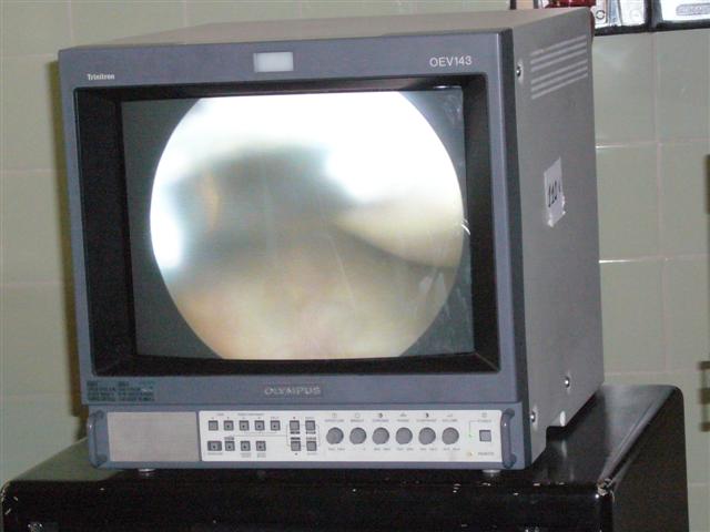 Travel - Bolivia - Knee Operation